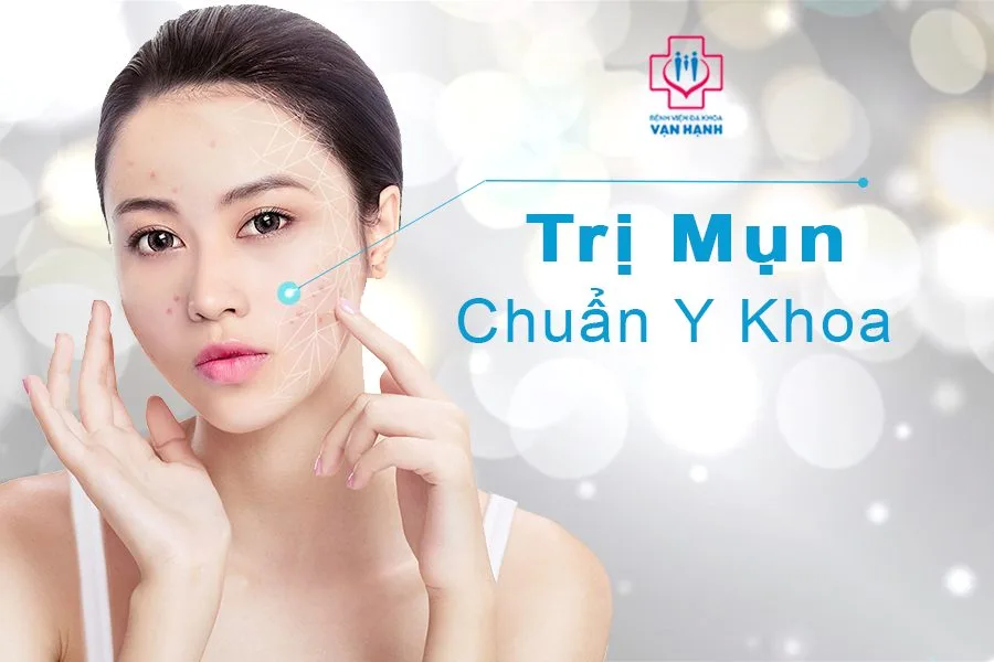 trị mụn cũng bác sĩ da liễu giỏi