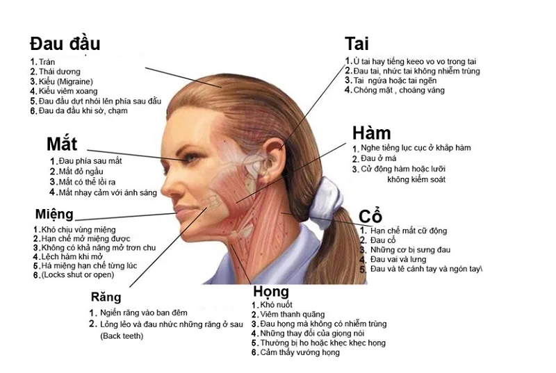 đau đầu