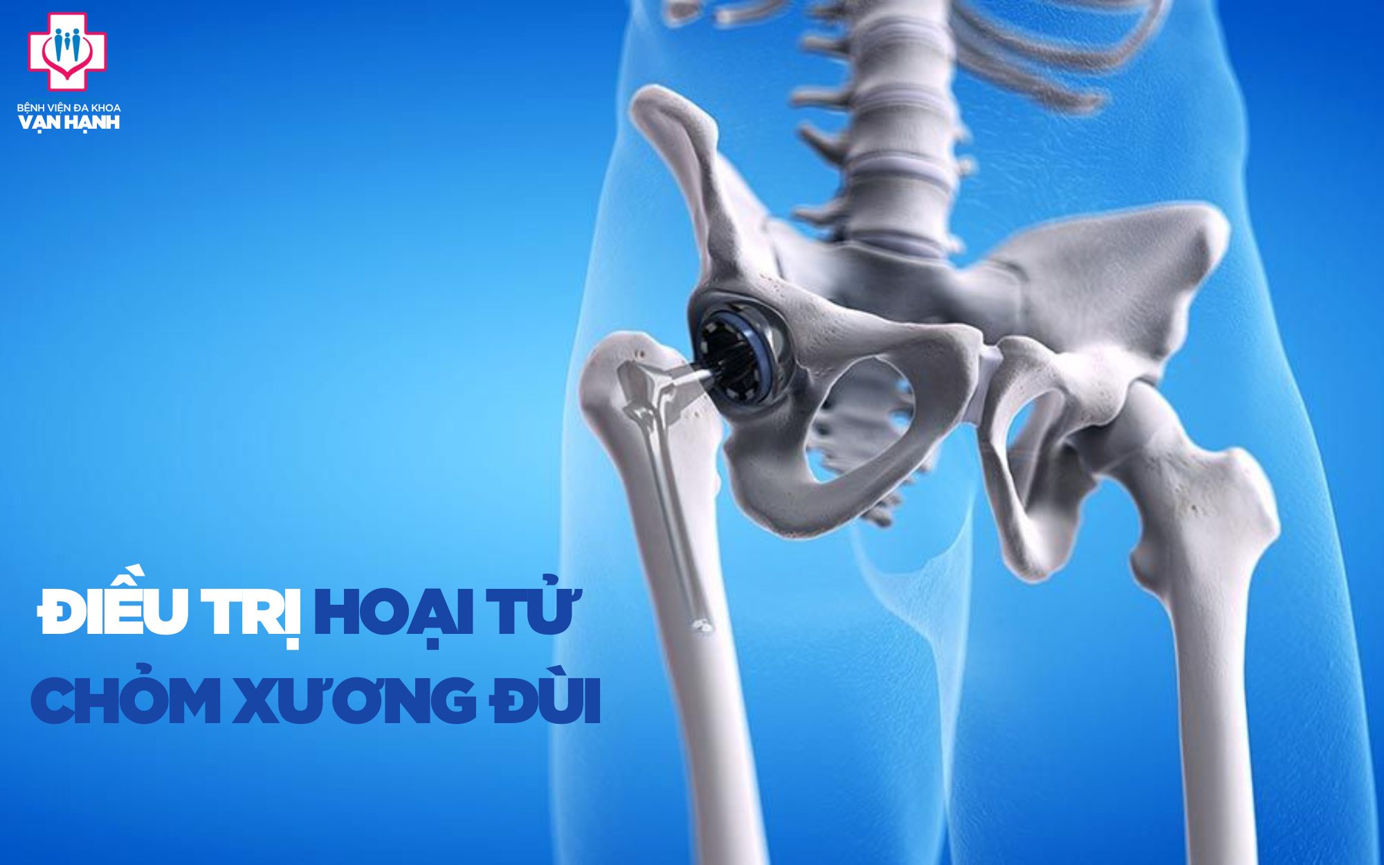 Diễn biến của hoại tử khớp háng như thế nào nếu không được điều trị kịp thời?
