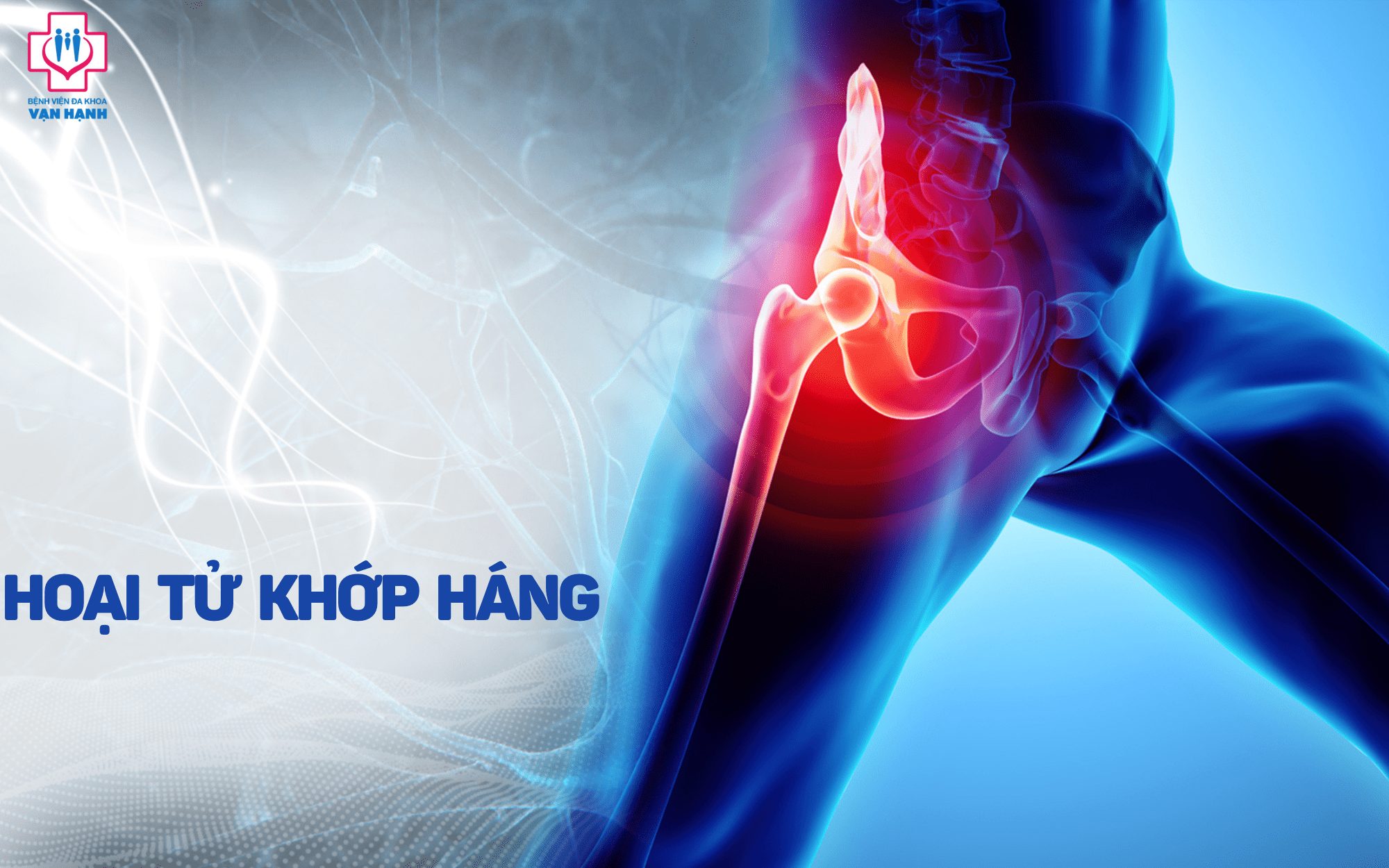 Phương pháp chữa trị cho hoại tử khớp háng và cải thiện chất lượng cuộc sống