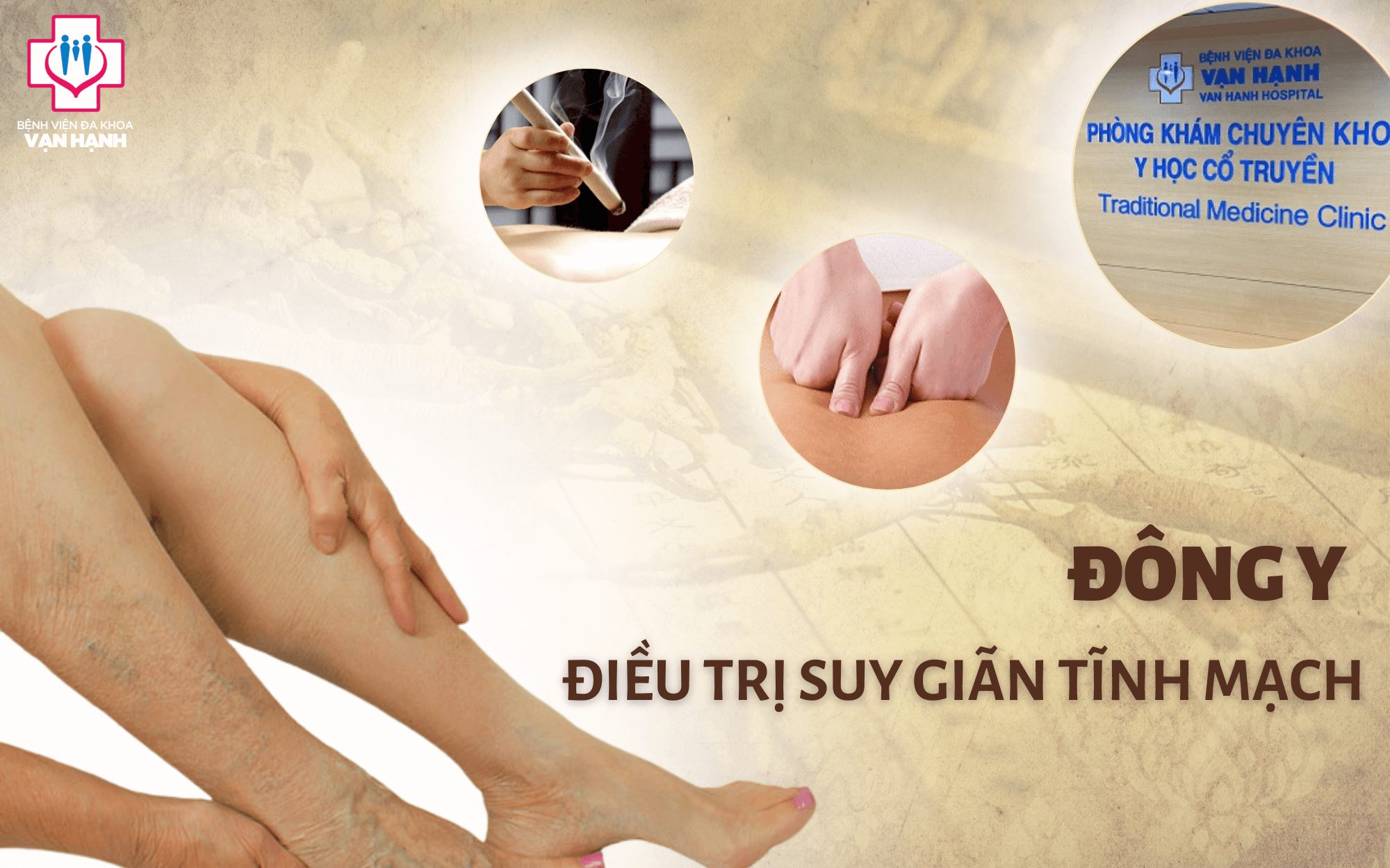 Hiệu quả của thuốc đông y trị suy giãn tĩnh mạch và cách giảm triệu chứng