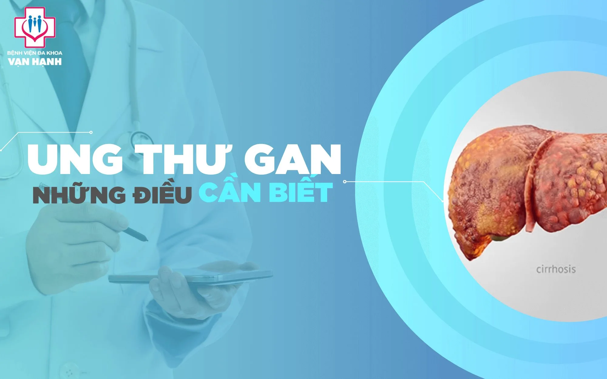 ung thư gan
