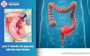 lưu ý trước và sau nội soi đại tràng