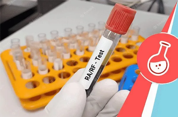 xét nghiệm rf
