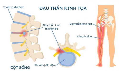 than-kinh-toa-1