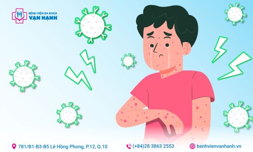 vaccine sởi