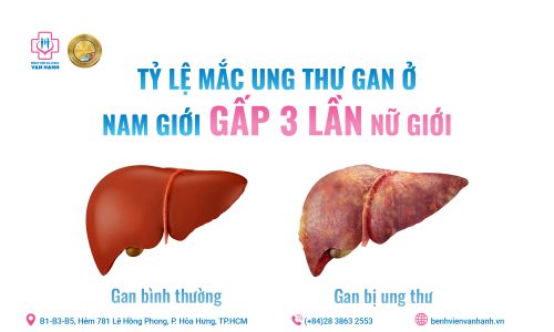251107 Tỷ lệ mắc ung thư gan ở nam giới gấp 3 lần nữ giới_Cover Zalo va Website_1600x900 2