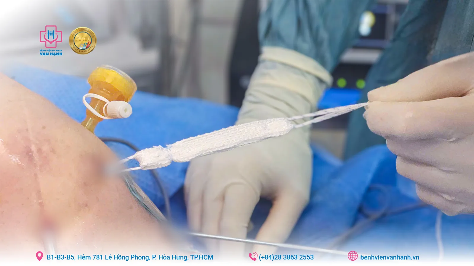 Đứt dây chằng chéo lần thứ 2, đa tổn thương khớp gối