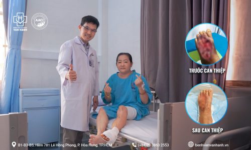 BS Huỳnh Thế Vinh trực tiếp phẫu thuật gh&eacute;p da cho bệnh nh&acirc;n đ&aacute;i th&aacute;o đường