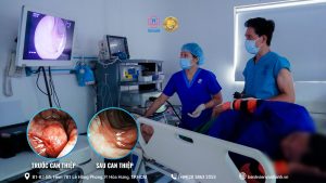 Phẫu thuật ung thư đường tiêu hóa