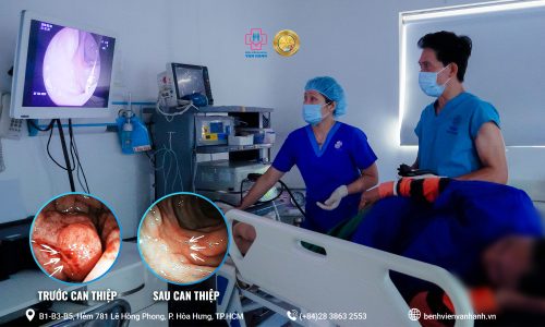 Phẫu thuật ung thư đường ti&ecirc;u h&oacute;a