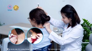 Điềutrị châm cứu sau chấn thương