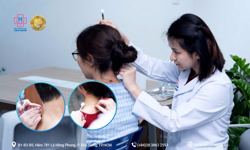 Điềutrị ch&acirc;m cứu sau chấn thương