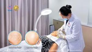Ứng dụng tế bào gốc vào trẻ hóa làn da