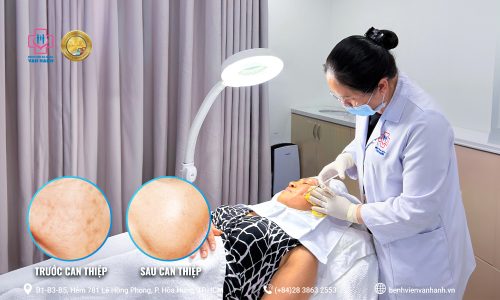 Ứng dụng tế b&agrave;o gốc v&agrave;o trẻ h&oacute;a l&agrave;n da