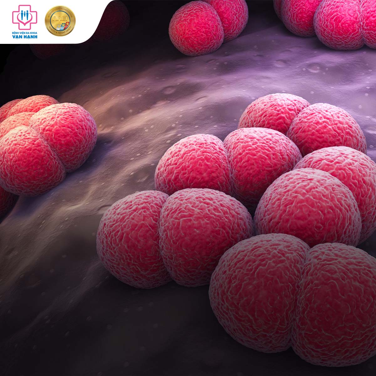 Viêm màng não mô cầu do vi khuẩn Neisseria meningitidis