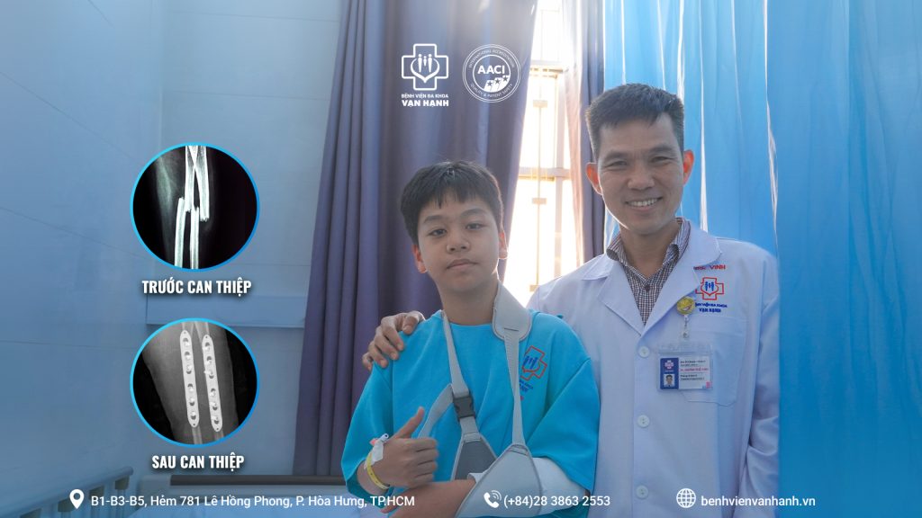 Phẫu thuật cấp cứu thành công ca gãy gập hai xương cẳng tay ở bệnh nhi 13 tuổi
