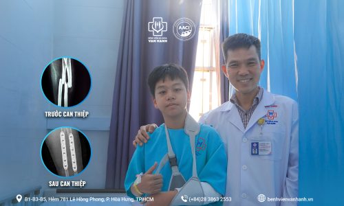 Phẫu thuật cấp cứu th&agrave;nh c&ocirc;ng ca g&atilde;y gập hai xương cẳng tay ở bệnh nhi 13 tuổi