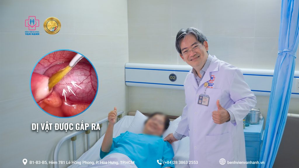Nuốt phải xương cá gây thủng ruột non: Cảnh báo biến chứng nguy hiểm từ thói quen ăn uống