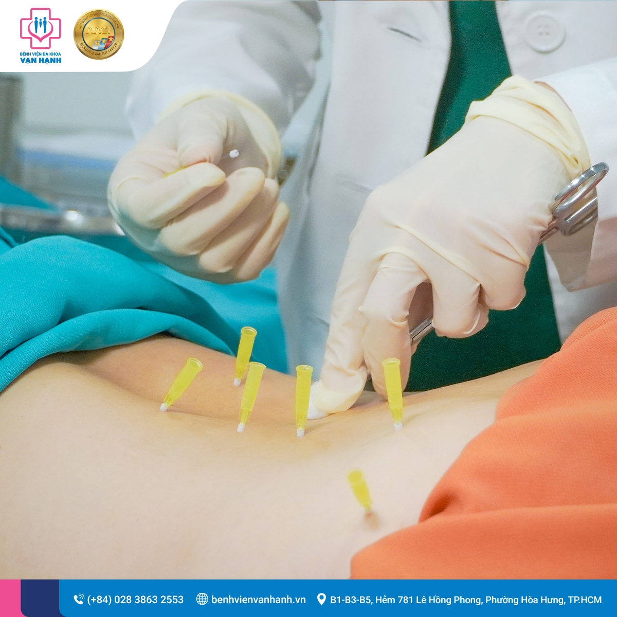 Lồi đĩa đệm gây đau lưng & cổ vai gáy trầm trọng: Bệnh nhân Việt Kiều kiên trì về nước Cấy Chỉ phục hồi