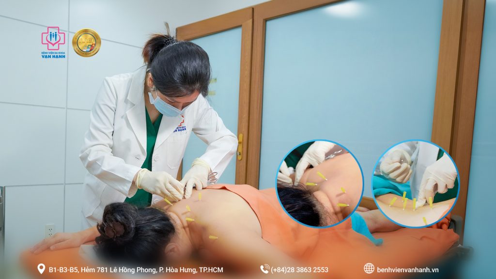 Cấy chỉ điều trị thoát vị đĩa đệm cho bệnh nhân