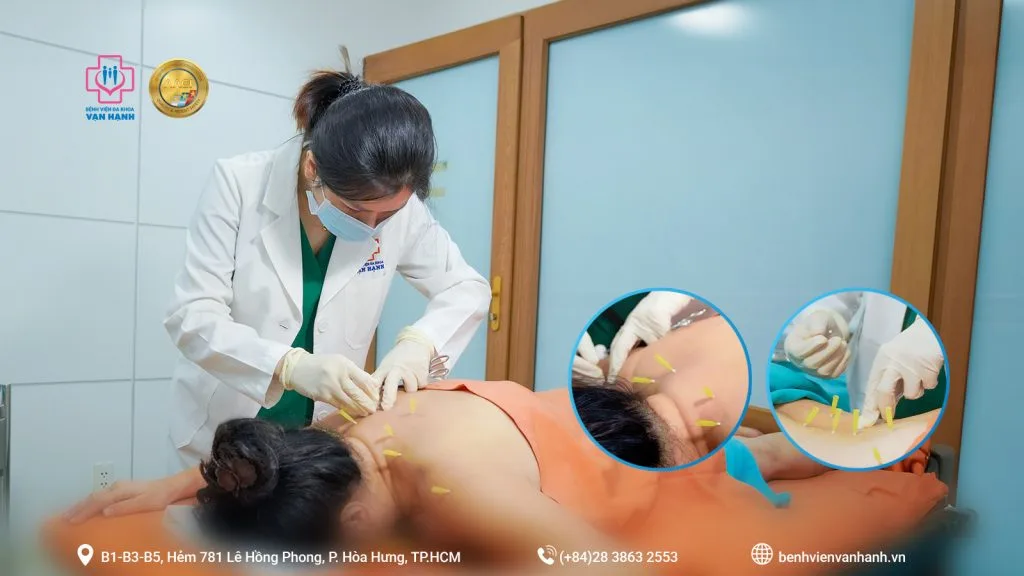 Cấy chỉ điều trị thoát vị đĩa đệm cho bệnh nhân