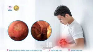 Lạm dụng thuốc dạ dày - Lợi ích tạm thời, hệ luỵ khôn lường