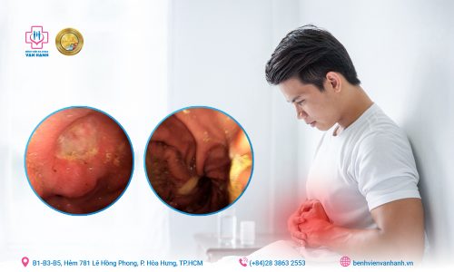 Lạm dụng thuốc dạ d&agrave;y - Lợi &iacute;ch tạm thời, hệ luỵ kh&ocirc;n lường