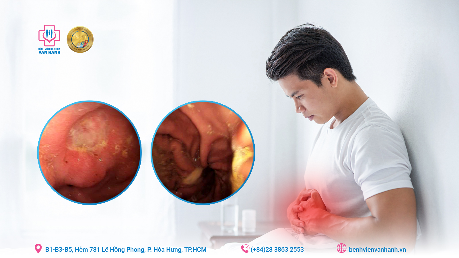 Lạm dụng thuốc dạ dày - Lợi ích tạm thời, hệ luỵ khôn lường