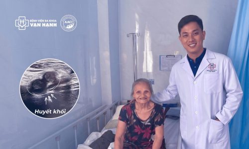 CAN THIỆP CẤP CỨU TẮC ĐỘNG MẠCH CHI DƯỚI TR&Ecirc;N BỆNH NH&Acirc;N SUY TIM NẶNG V&Agrave; RUNG NHĨ
