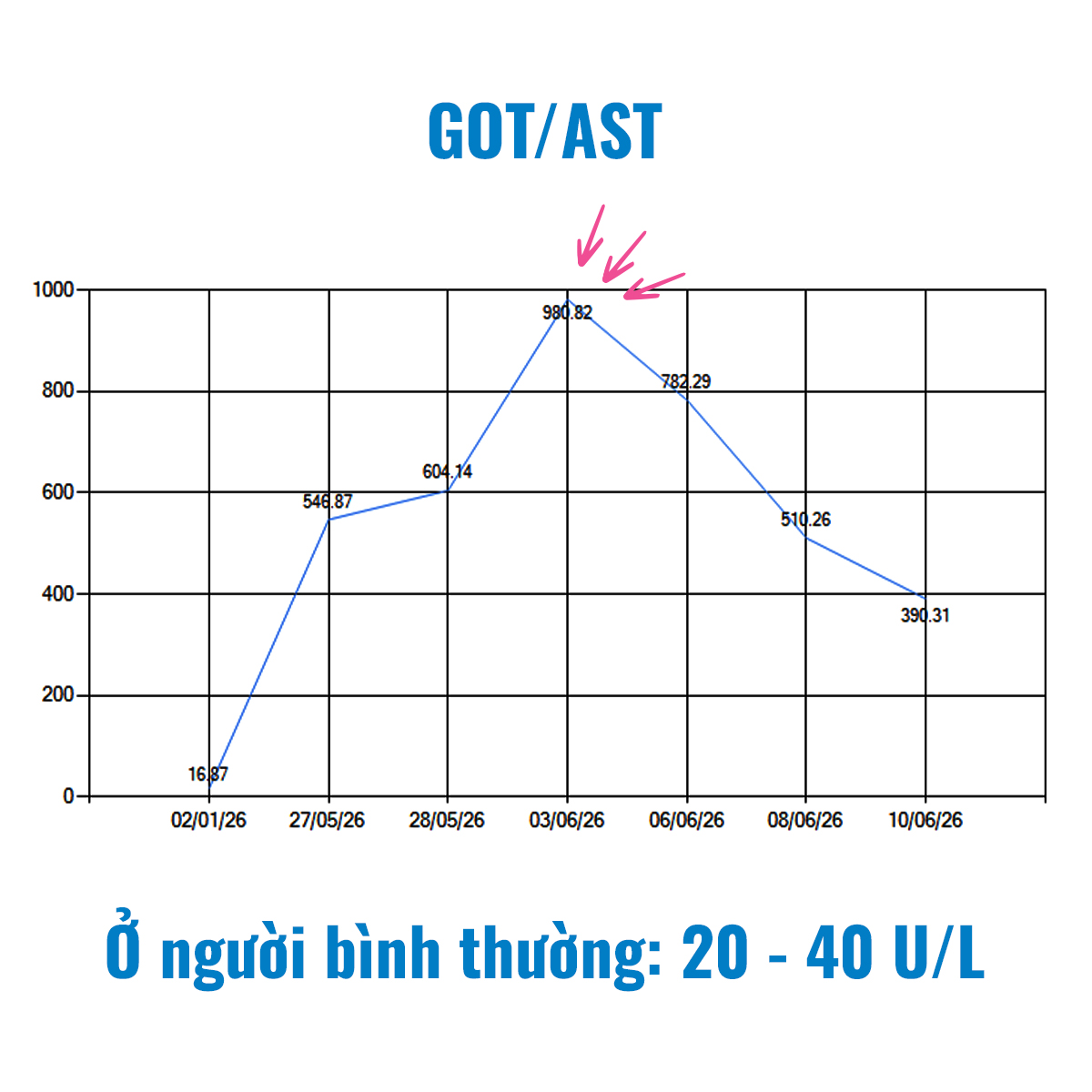 Chỉ số men gan tăng cao gần 1000 U/L (so với người bình thường chỉ 20-40 U/L)